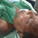 Diduga Dianiaya, Penghuni Sel Tahanan Polrestabes Medan Sampai Tewas