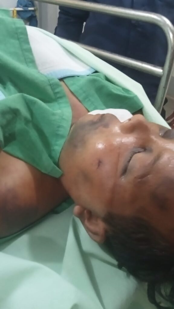 Diduga Dianiaya, Penghuni Sel Tahanan Polrestabes Medan Sampai Tewas